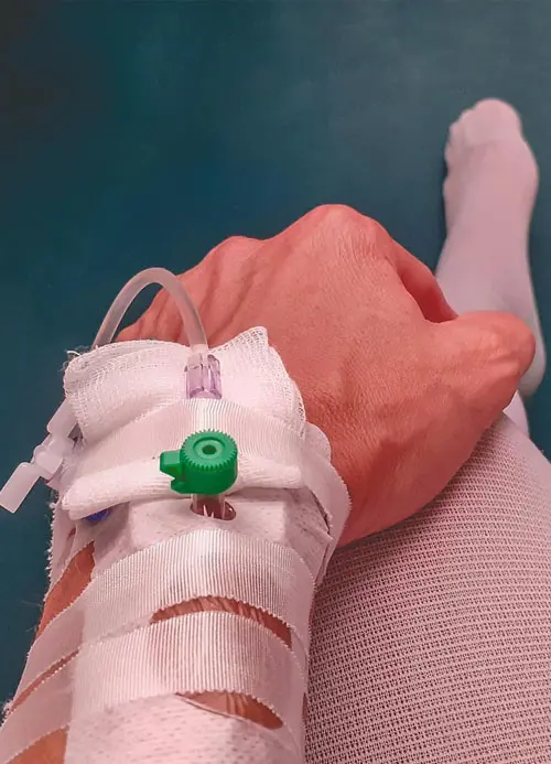 Rémunération infirmières spécialisées bloc opératoire